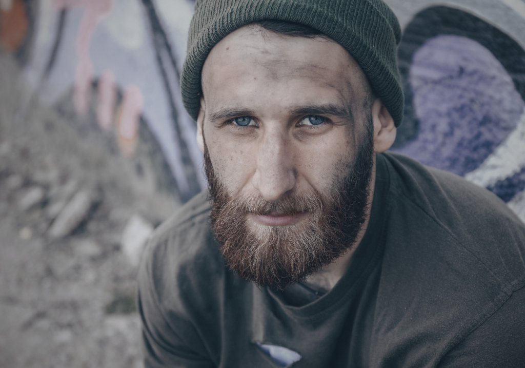 homeless man with dirt on his face